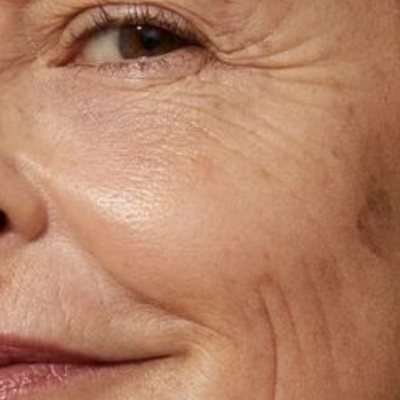 Close-up of a person's eye with visible signs of aging, wrinkles.
