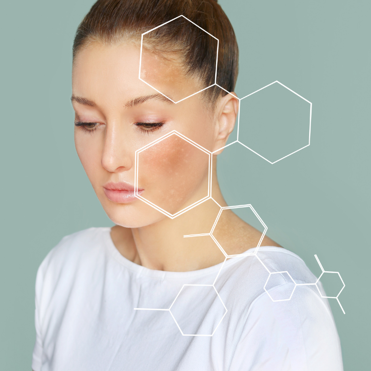 What is Kojic Acid? Skin Benefits & How Does It Works in Soaps?